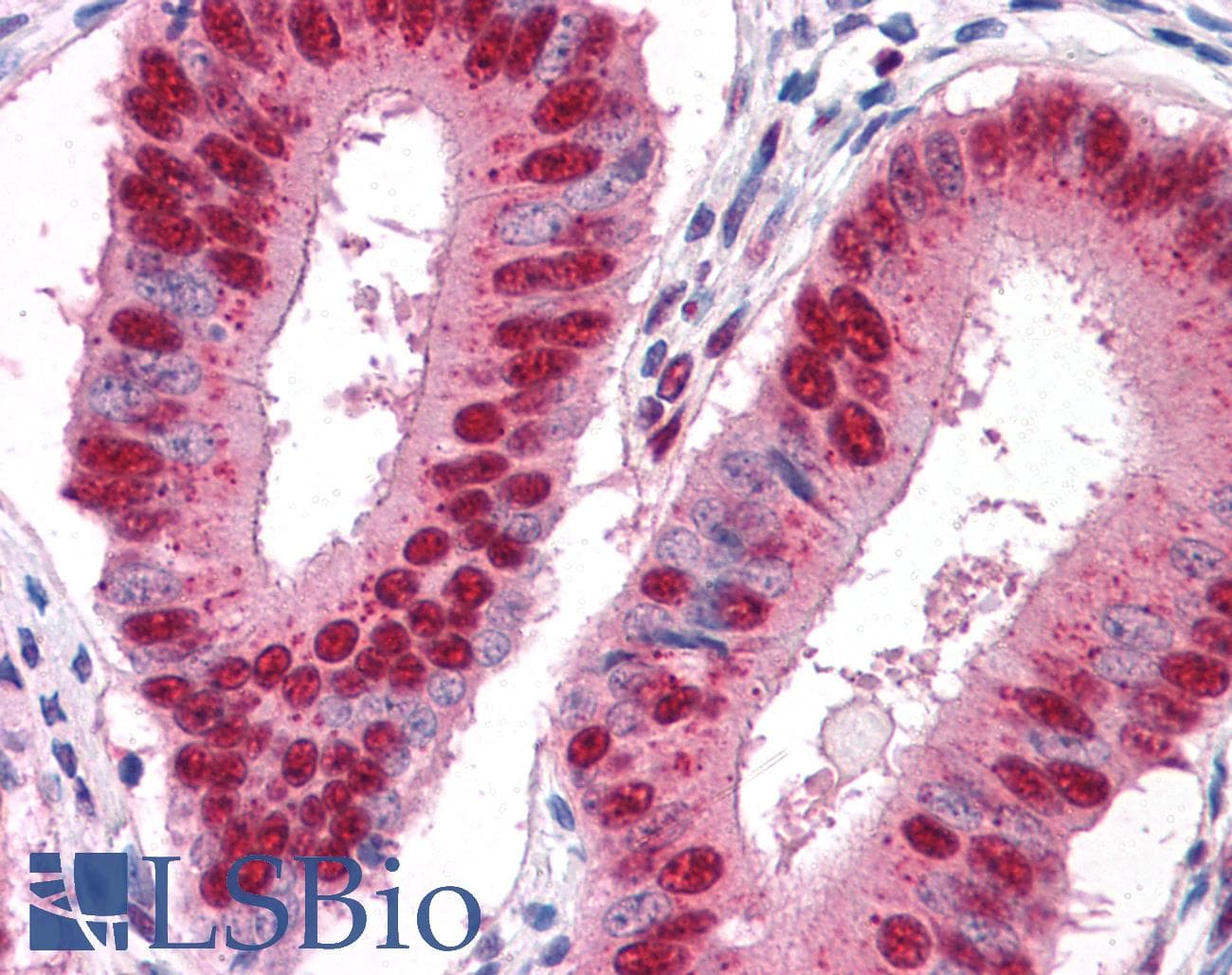 IHC-plus™ MUM1 Antibody (clone 4G10)