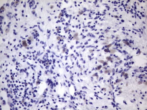 VWF / Von Willebrand Factor Antibody (aa764-1263, clone OTI9F3)