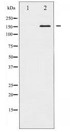 Rho Kinase / ROCK1 Antibody