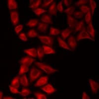 NEIL1 Antibody