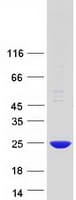 Human POP7 Protein (Recombinant Myc-DDK (Flag))