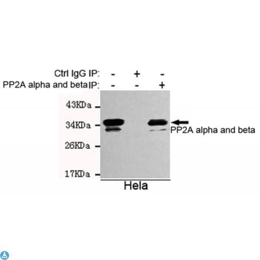 PP2CB / PPP2CB Antibody