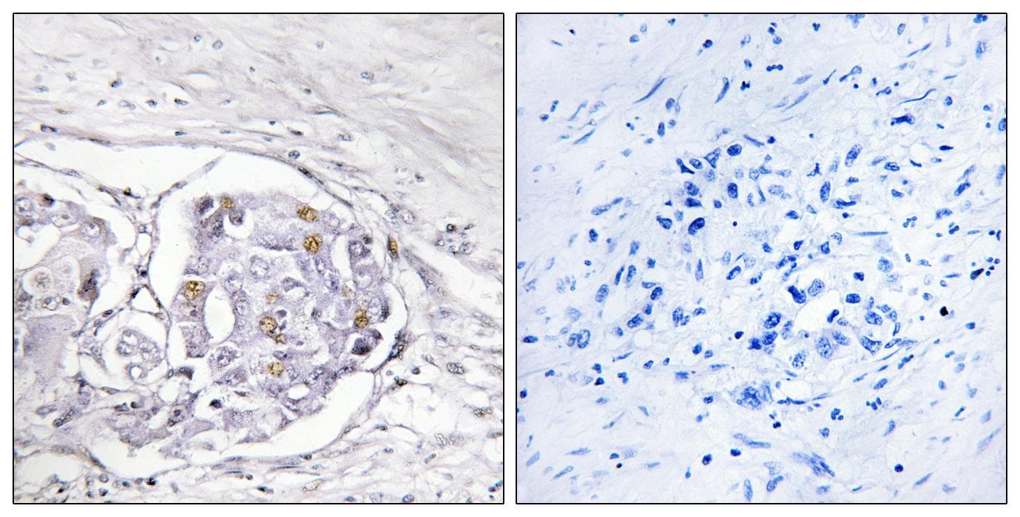 Polyclonal Rabbit anti-Human PR / Progesterone Receptor Antibody (Ab-294, IHC, IF)