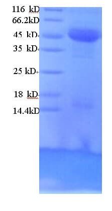Human DCP2 Protein (Recombinant His)