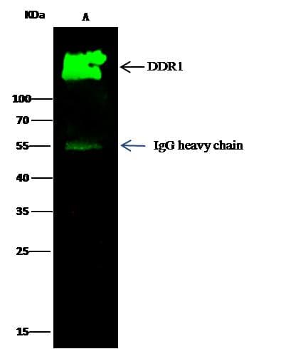 Monoclonal Rabbit anti-Human NEP / DDR1 Antibody (clone 203, Preservative Free, WB)