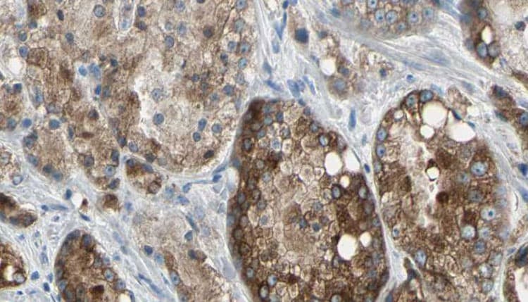 Polyclonal Rabbit anti-Human TLR5 Antibody (IHC, WB)