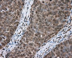 ACSBG1 / hsBG Antibody (clone OTI2B6)