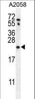 Polyclonal Rabbit anti-Human RAB10 Antibody (aa89-117, WB)