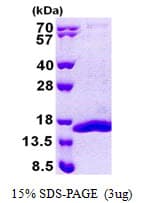 Human COX5B Protein (Recombinant His)