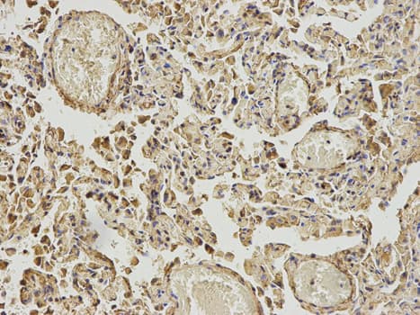 IHC-plus™ ABAT Antibody