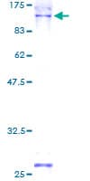 Human NCBP1 / CBP80 Protein (Recombinant GST)