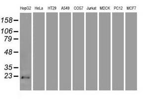Monoclonal Mouse anti-Human p16INK4a / CDKN2A Antibody (clone OTI4C11, IF, WB)