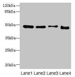 Polyclonal Rabbit anti-Human DDI2 Antibody (IHC, WB)
