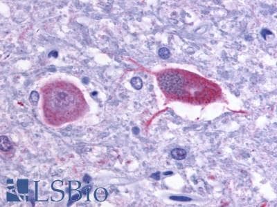 PathPlus™ Polyclonal Rabbit anti-Human GRM1 / MGLUR1 Antibody (C-Terminus, IHC)