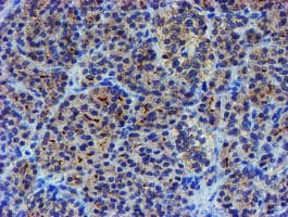 LHX1 Antibody (aa100-362, clone OTI2D5)