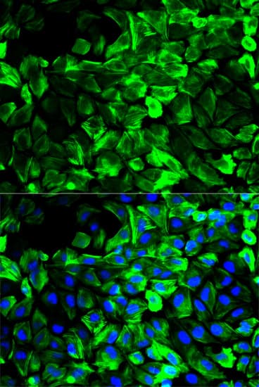 IHC-plus™ Polyclonal Rabbit anti-Human TPM1 / Tropomyosin Antibody (IHC, IF, WB)
