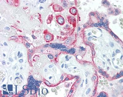 IHC-plus™ TIAM1 Antibody
