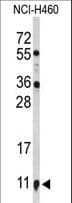 S100A10 Antibody (aa12-40)