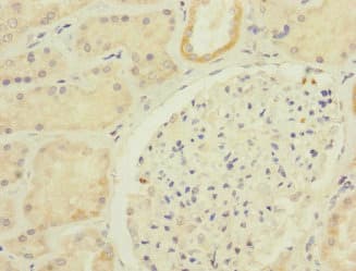 Polyclonal Rabbit anti-Human CDH10 / Cadherin 10 Antibody (aa20-260, IHC)