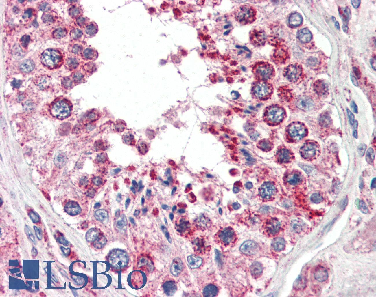 IHC-plus™ COXIV / COX4 Antibody (aa154-166)