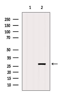 GSTO2 Antibody