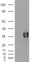 Monoclonal Mouse anti-Human EPCAM Antibody (clone OTI2H9, IF, WB)
