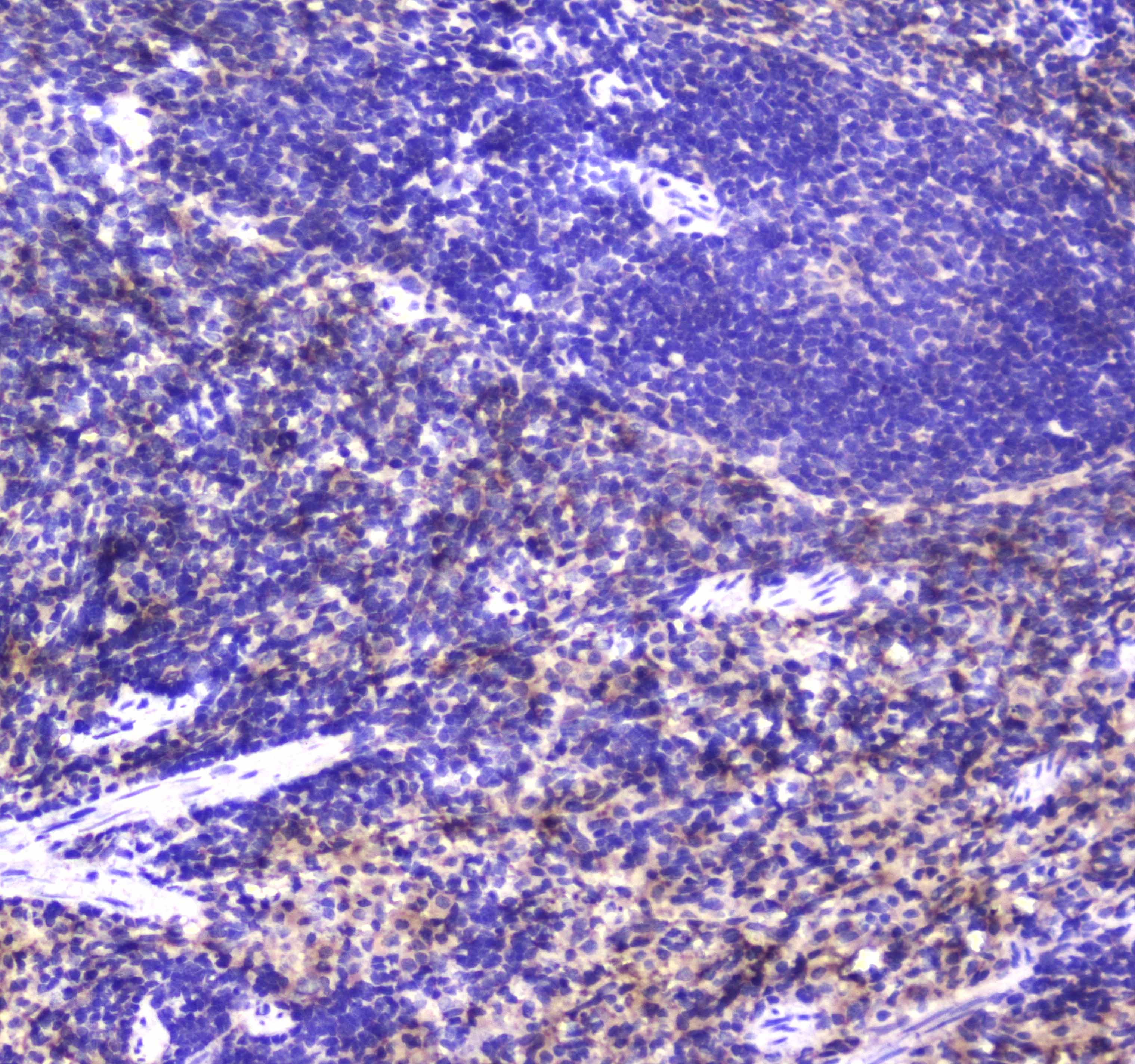 Polyclonal Rabbit anti-Human NCR1 / NKP46 Antibody (IHC, WB)