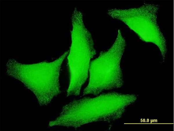 PKD2 / Polycystin 2 Antibody (clone 4C8)