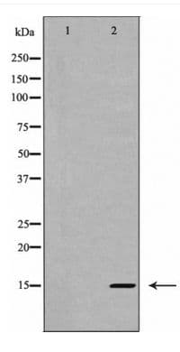 Polyclonal Rabbit anti-Human IL5 Antibody (IHC, WB)