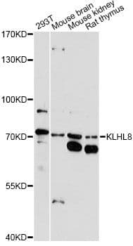 Polyclonal Rabbit anti-Human KLHL8 Antibody (WB)