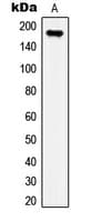 Polyclonal Rabbit anti-Human IRS1 Antibody (phospho-Ser307, IHC, WB)