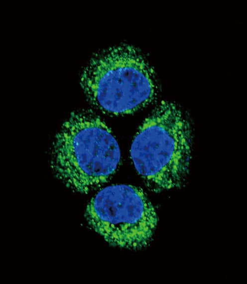GLS / Glutaminase Antibody (aa516-545)
