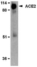 PathPlus™ ACE2 / ACE-2 Antibody