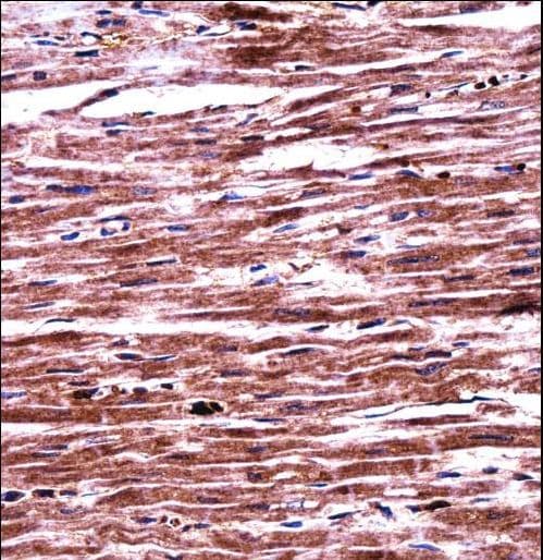RNF19A / DORFIN Antibody (aa384-413)