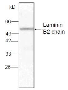LAMC1 / Laminin Gamma 1 Antibody (aa526-1106)