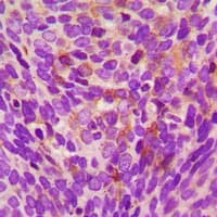 GNRH Antibody