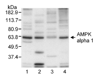 Polyclonal Rabbit anti-Human PRKAA1 / AMPK Alpha 1 Antibody (IHC, WB)