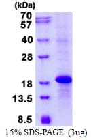 Human KLRC3 / NKG2E Protein (Recombinant His)