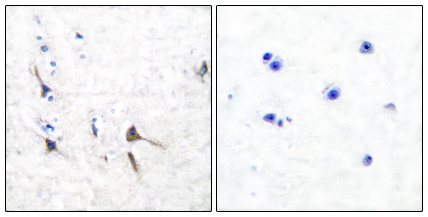 KCNC2 / Kv3.2 Antibody