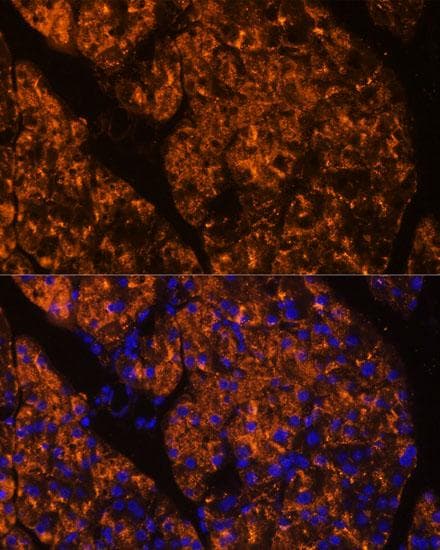 SERPINI2 / PANCPIN Antibody
