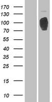 RRBP1 / hES Protein (Over-Expression Lysate Myc-DDK (Flag))