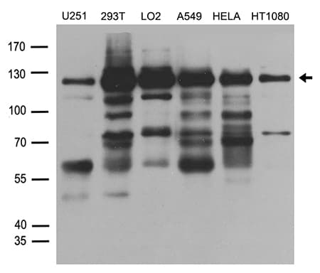 SMARCA3 / HLTF Antibody