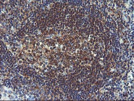 Monoclonal Mouse anti-Human VBP1 Antibody (clone OTI2C2, IHC, WB)