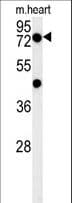 Polyclonal Rabbit anti-Human PHTF2 Antibody (aa420-448, WB)