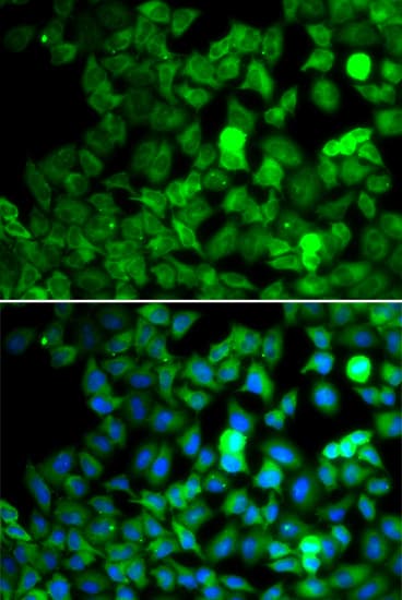 Polyclonal Rabbit anti-Human SARS / Serine-tRNA Ligase Antibody (IHC, IF, WB)