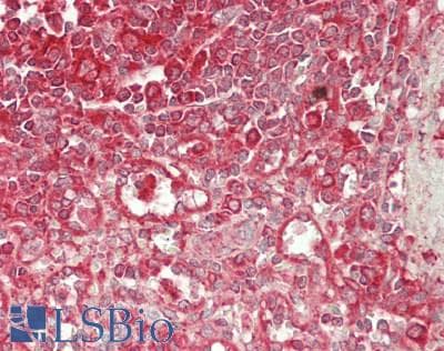 IHC-plus™ PES1 Antibody (aa25-75)