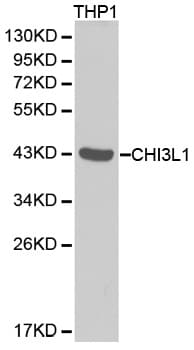 IHC-plus™ Polyclonal Rabbit anti-Human CHI3L1 / YKL-40 Antibody (IHC, WB)