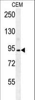 Polyclonal Rabbit anti-Human BCAN / Brevican Antibody (aa715-741, IHC, WB)