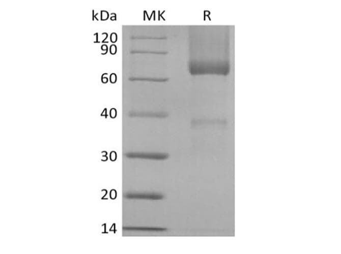 Rhesus monkey GPC3 / Glypican 3 Protein (Recombinant 6His, C-terminus)