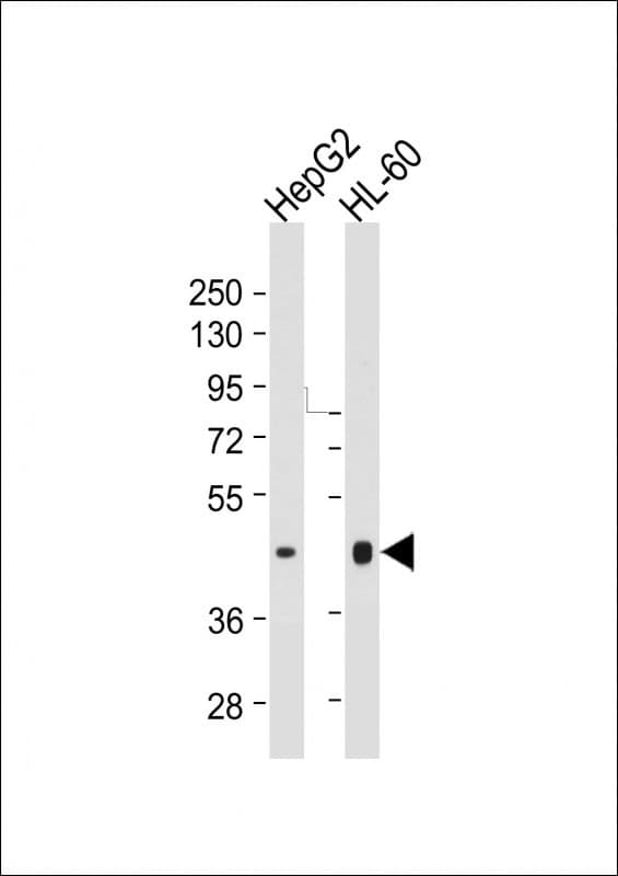 Monoclonal Mouse anti-Human HLA-F Antibody (clone 2010CT523.67.51, WB)